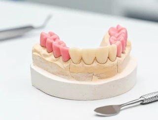 آشنایی با وکس اپ تشخیص diagnostic wax up و مراحل آن