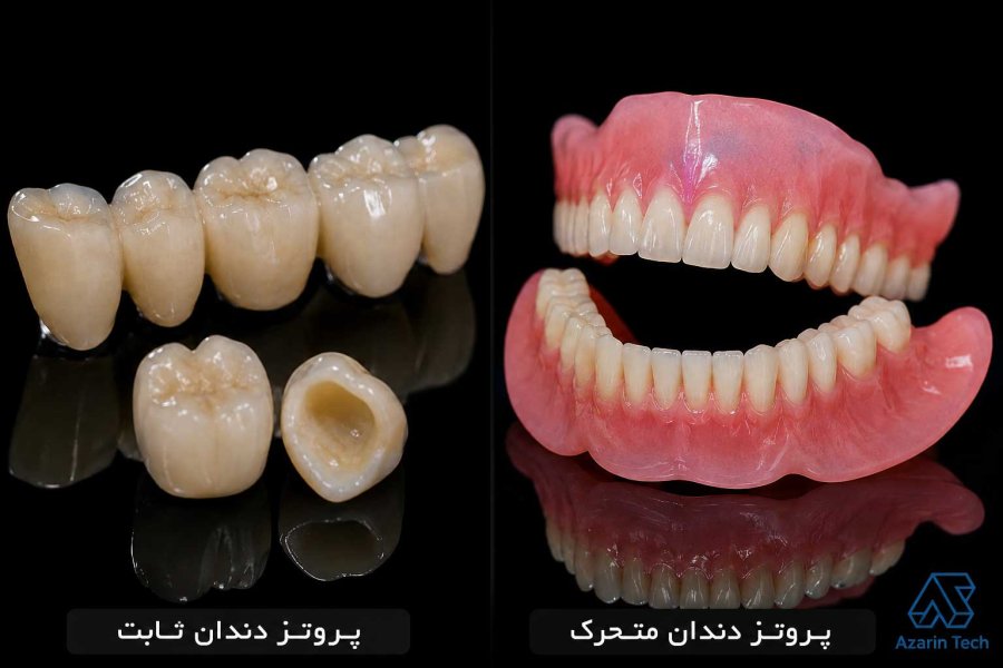 راهنمای کامل انواع پروتزهای دندانی ثابت و متحرک؛ کدام گزینه بهتر است؟