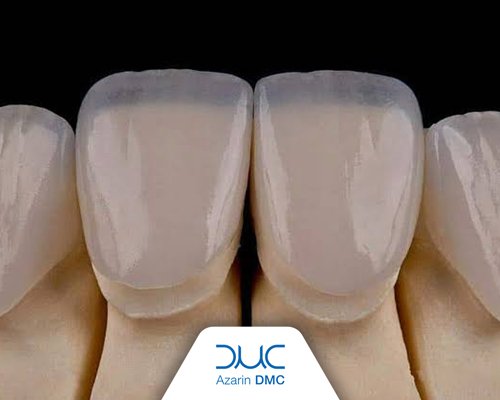 گلس سرامیک تقویت شده چیست؟ کاربرد، مزایا و انواع آن