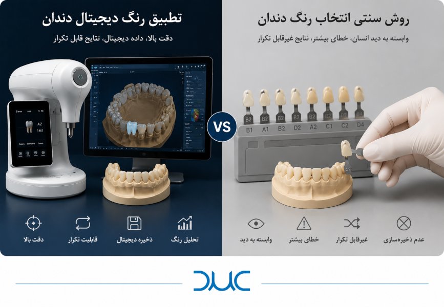 تطبیق رنگ دیجیتال دندان  و اهمیت آن در لابراتوار