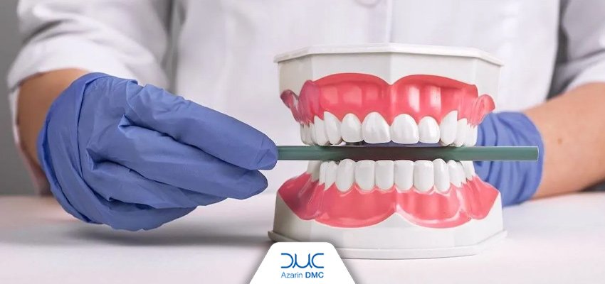 اکلوژن در پروتزهای دندانی چیست؟ بررسی نقش آن در طراحی و عملکرد پروتز