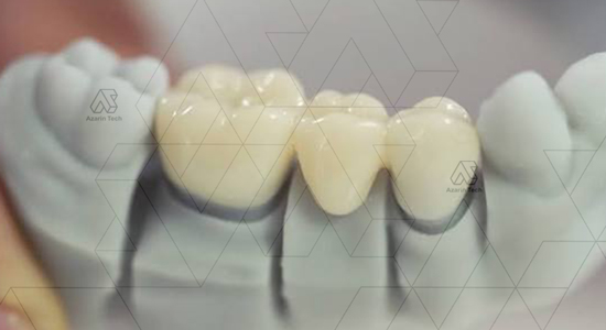 خدمات پرینت رزینی SLA در مشهد
